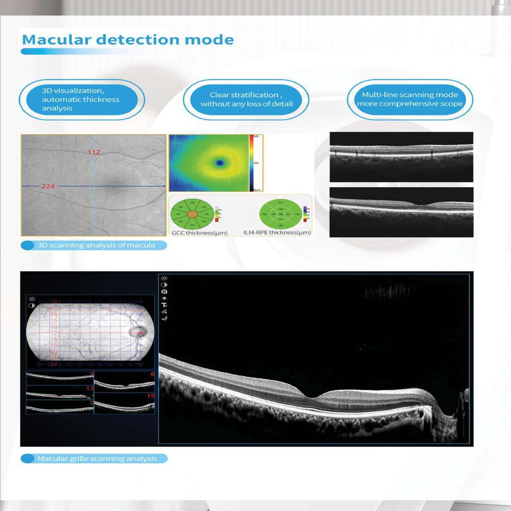 Eyevis Optical Coherence Tomography OCT