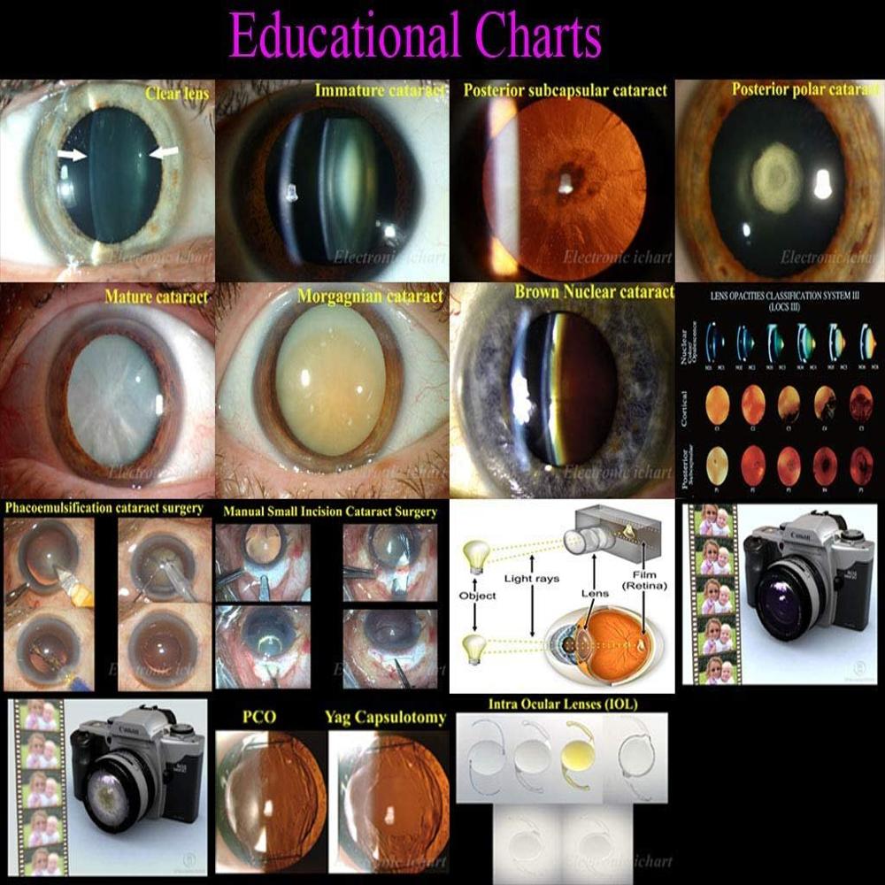 Lab Medica Vision Chart