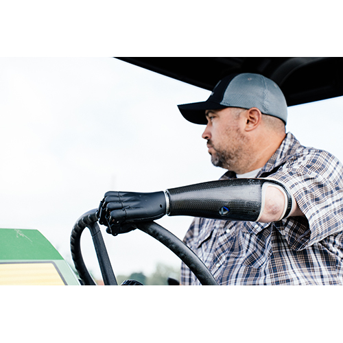 Zeus - Locally repairable Prosthetic Hand