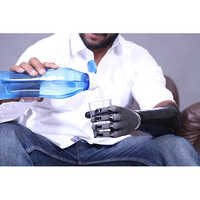 Zeus - Your Everyday Prosthetic Hand