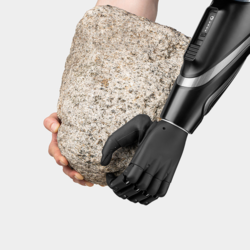 Prosthetic Hand