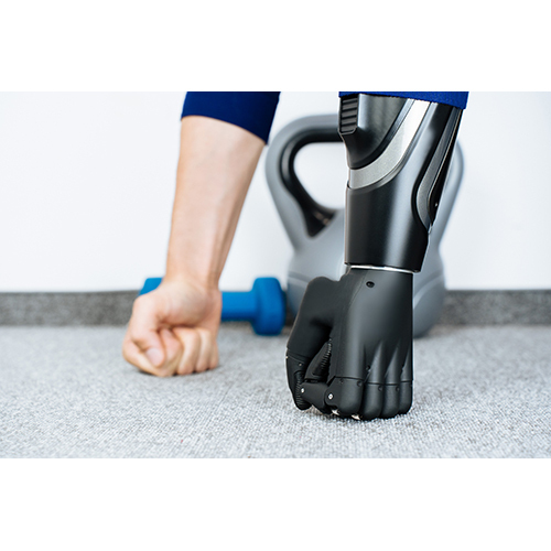 Prosthetic Arm