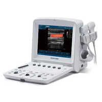 Portable Ultrasound Machine - Lcd Display, Semi-automatic Operation | Portable, Low Power Consumption, 1-year Warranty, Medical Diagnostics