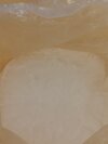 Magnesium sulfate