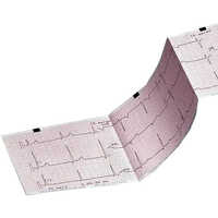 ECG Paper Rolls And Sheets