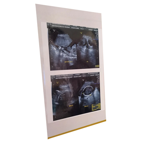 पेपर रोल्स के लिए लेमिनेशन शीट्स 6.5 इंच X 11 इंच