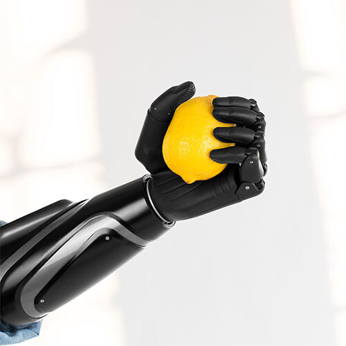 Above Elbow Bionic Hand