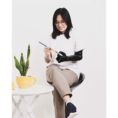 Above Elbow Bionic Hand