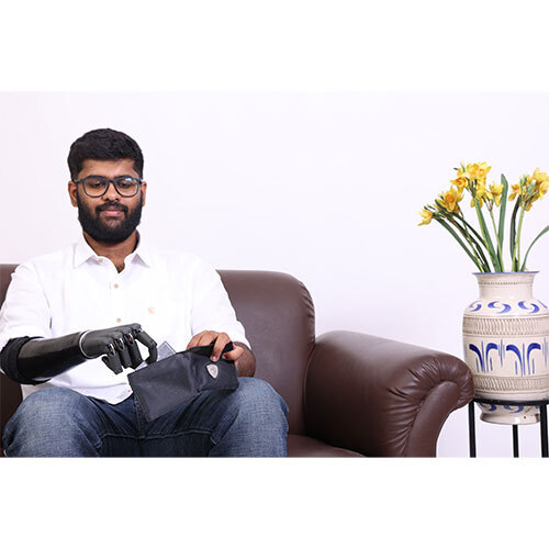 Above Elbow Bionic Hand