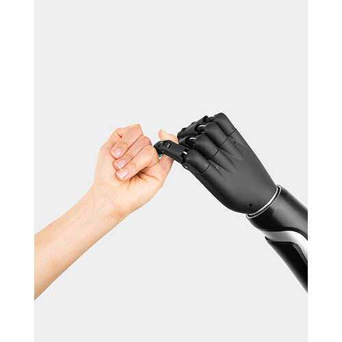 Below Elbow Bionic Hand