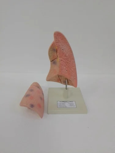 Human Lungs Model - Application: Hospital