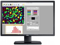 Metallography Image Analyzer