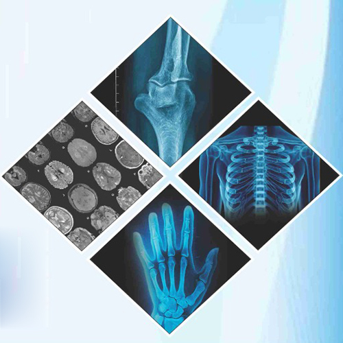 Digital Inkjet Blue X-Ray Film for Medical Radiological Images
