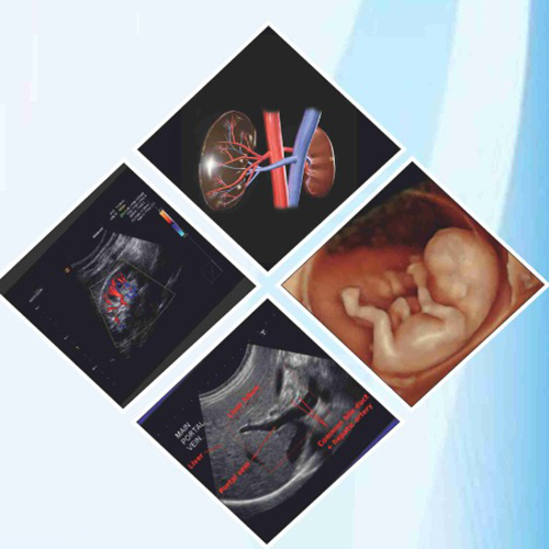 Digital Inkjet White X-Ray Film for Medical Radiological Images