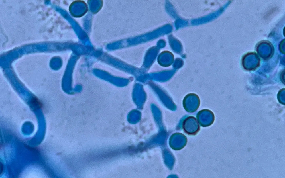 Trichoderma Viridie