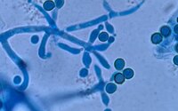 Trichoderma Viridie
