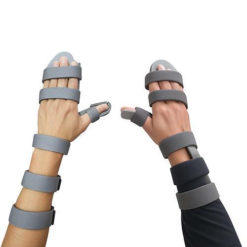 Static Splint Support