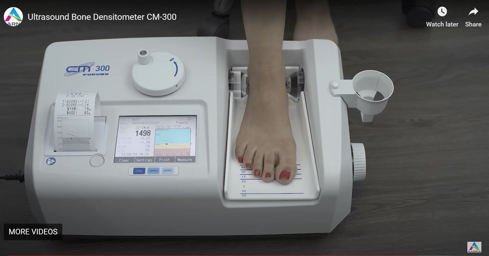 Japanese CM-300 Ultrasound Bone Densitometer