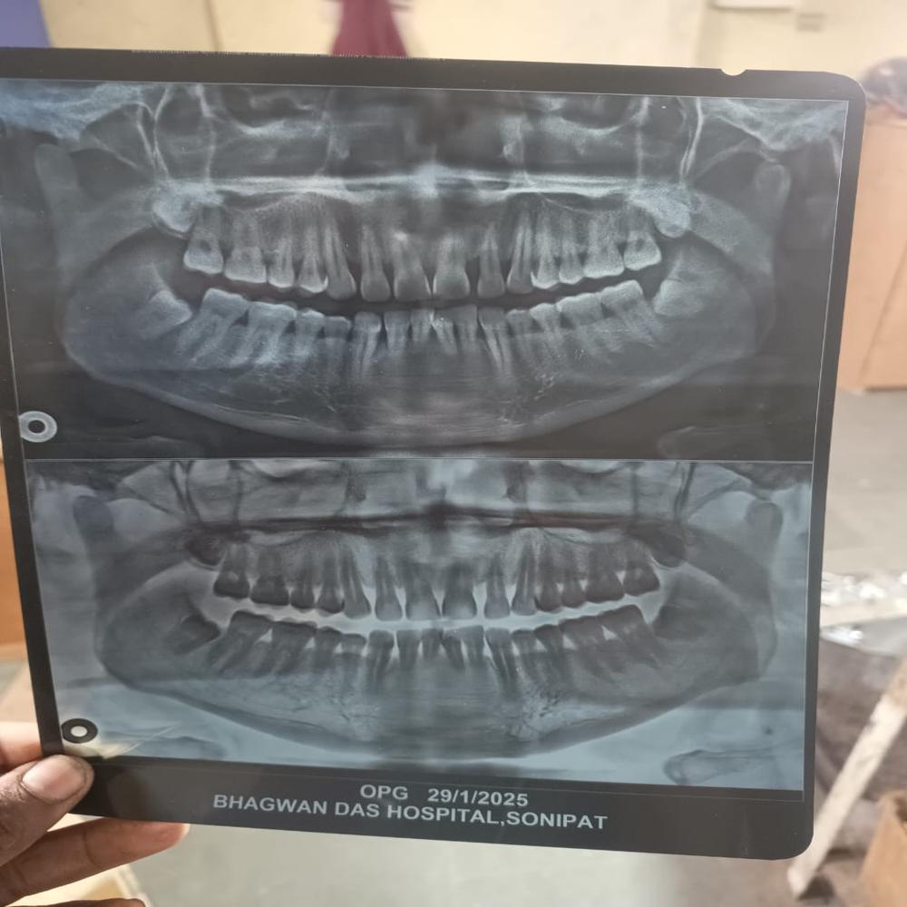 Dental Opg Machine