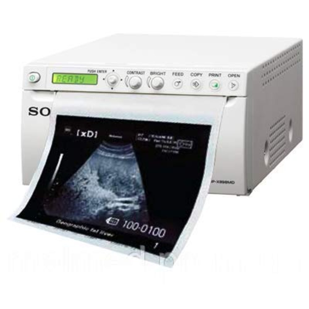 Ultrasound Sony Printer