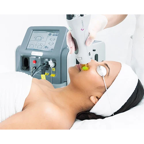 Hair Removal Laser Machine - Automation Grade: Fully Automatic