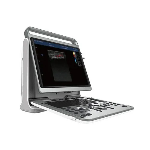 Chison Ebit 50 Ultrasound Machine - Application: Hospital