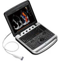 Chison Sonobook 8 Ultrasound Machine - Power Source: Electric