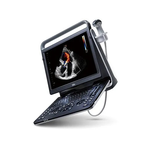 Chison Ebit 60 Ultrasound Machine - Application: Hospital