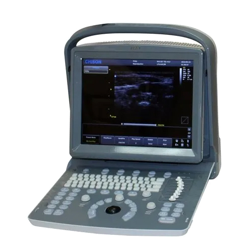 Chison Eco 1 Vet Ultrasound Machine - Application: Hospital