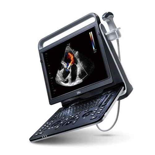 Chison Ebit 60 Vet Ultrasound Machine - Power Source: Battery