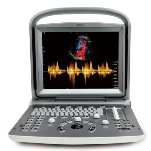 Chison Eco 6 Vet Ultrasound Machine - Power Source: Battery
