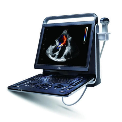 Echocardiogram Machine Portable - Power Source: Battery