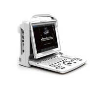 Black And White Ultrasound Scanner - Power Source: Battery
