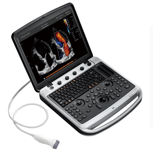 Chison B-W Ultra Sound Scanner - Power Source: Battery