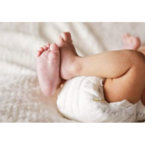 Xl Size 12-18 Kg Baby Diaper - Color: White