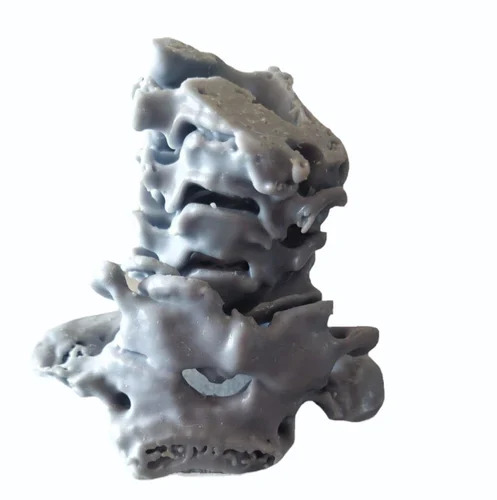 Printing Services of Patients' Anatomy Aids in Surgical Planning