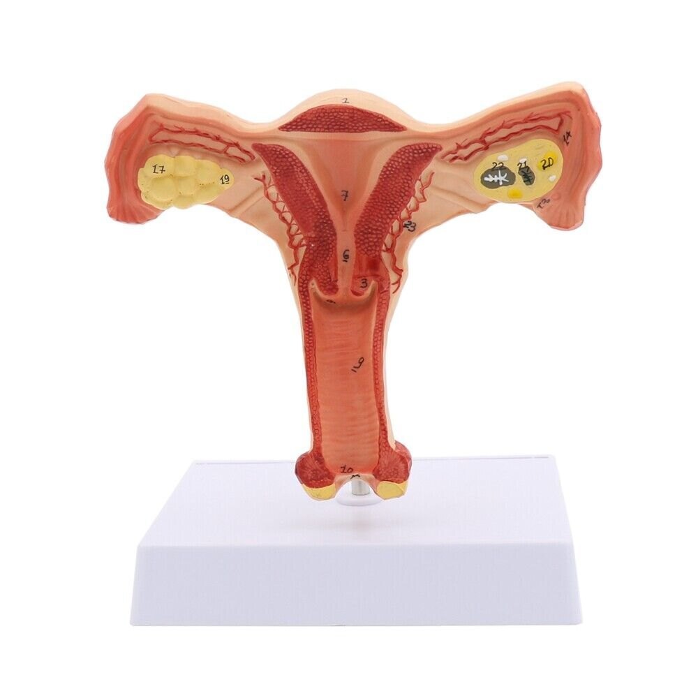 FEMALE Ovary Model