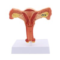 FEMALE Ovary Model