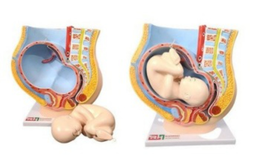 Female Pelvis With Baby - Application: Hospital