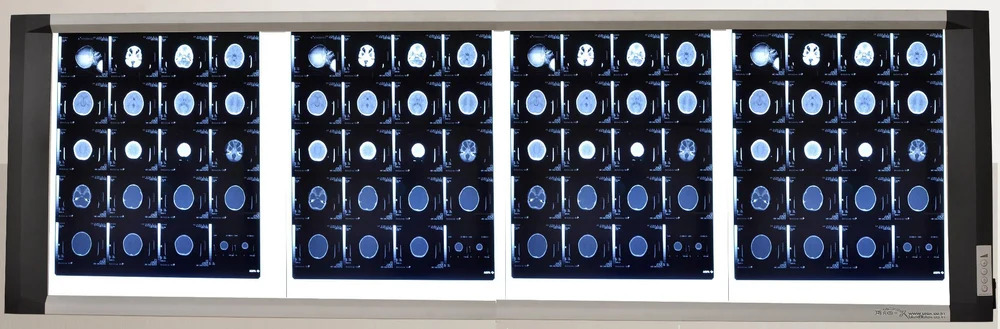 Four In One Screen Led X-ray View Box