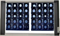 Double Screen Led X-Ray View Box