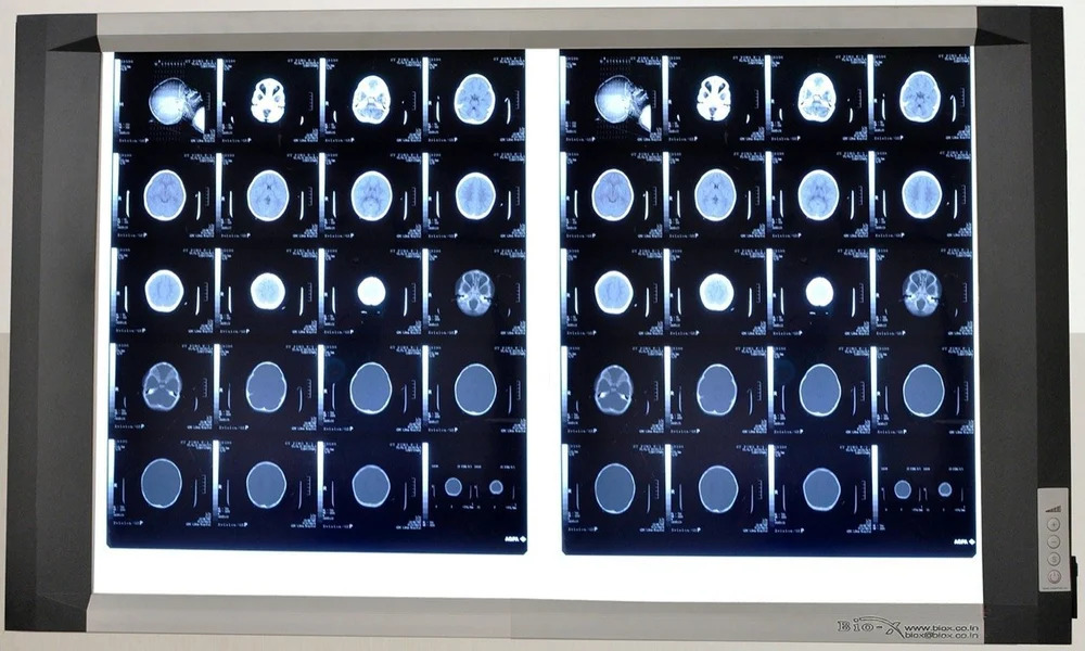 Double Screen Led X-ray View Box