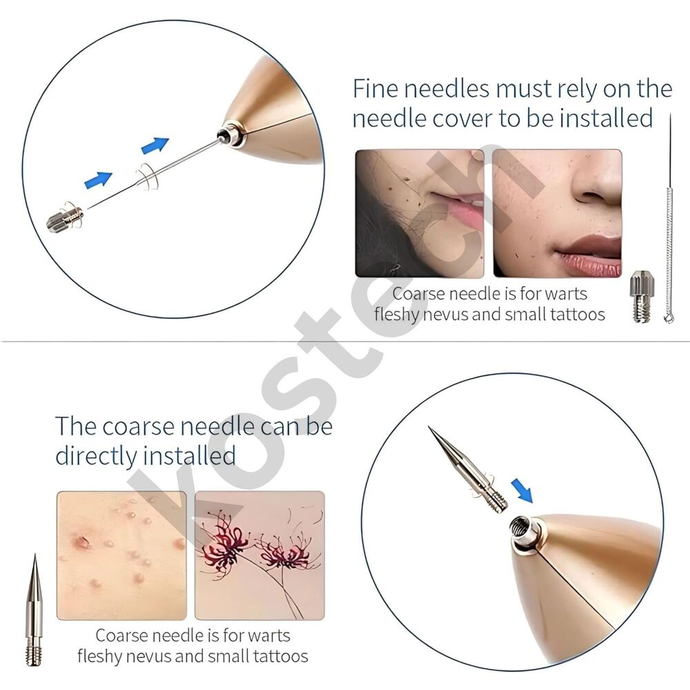 Cautery Pen - Color: White