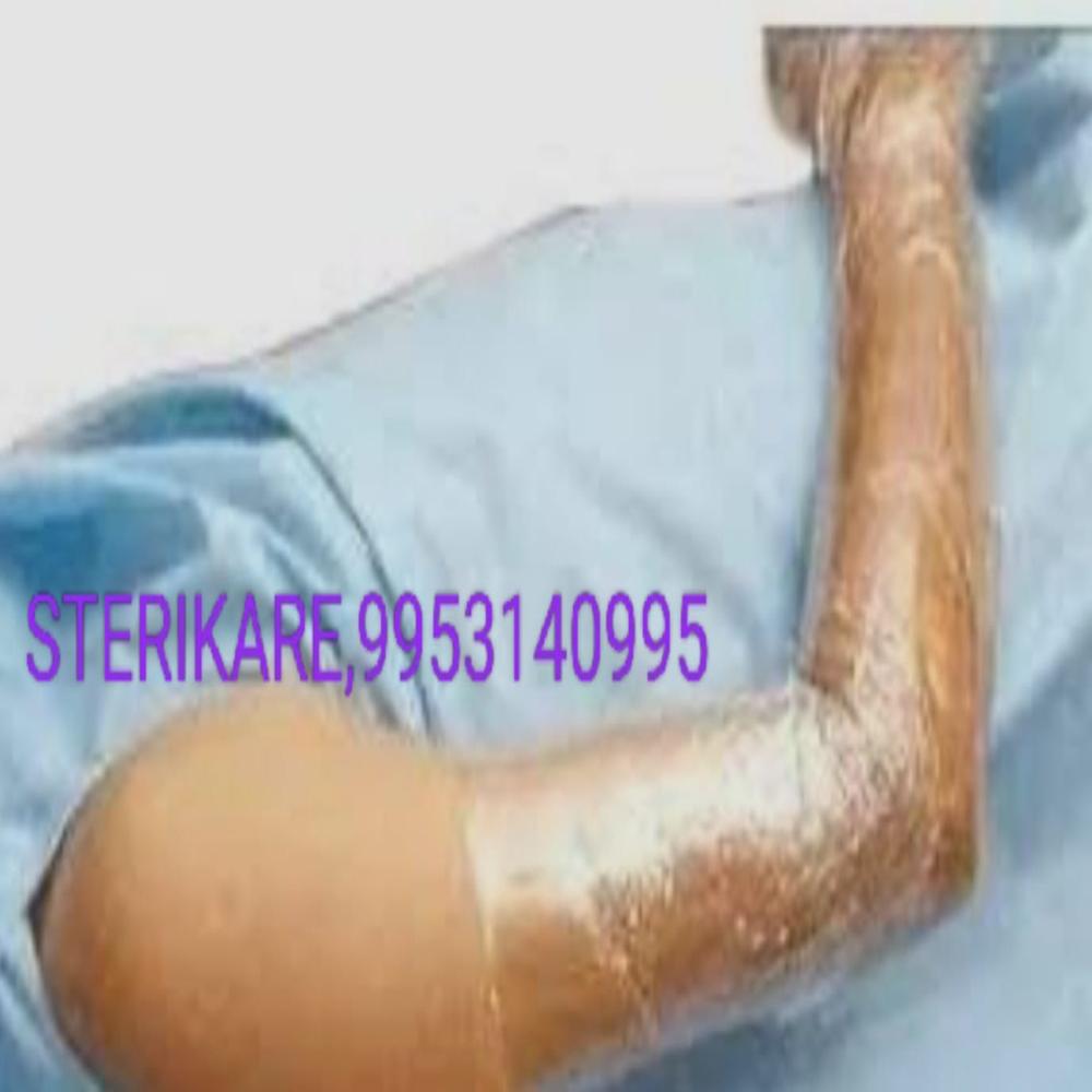 CLING DRAPE STERILE CUM SELF ADHERENT