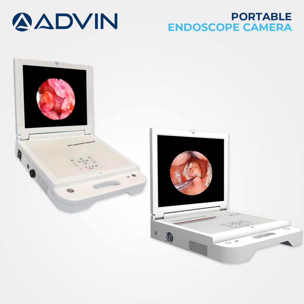 Portable Endoscope Camera