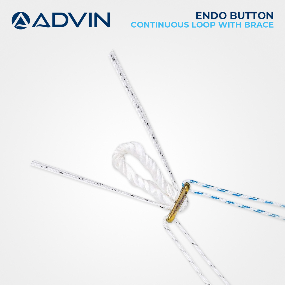 Endo Button Continuous Loop with Brace