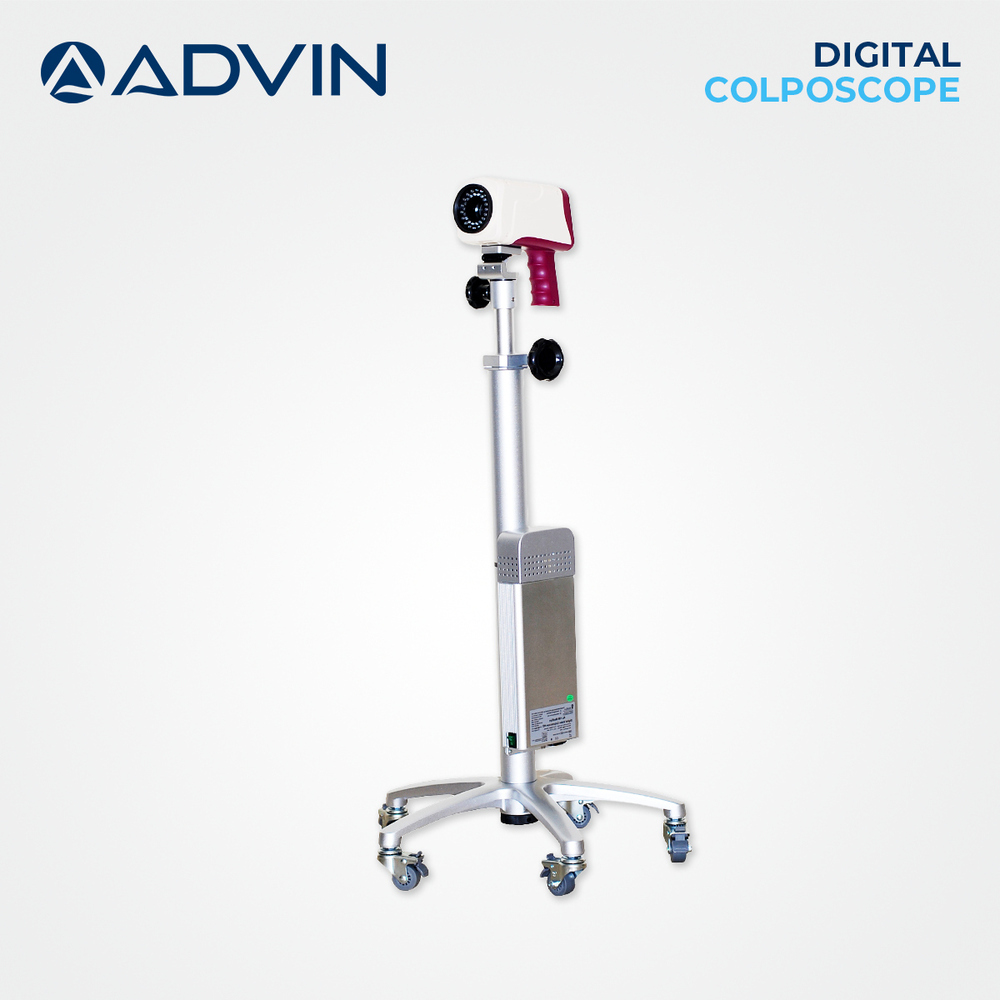 Digital Video Colposcope