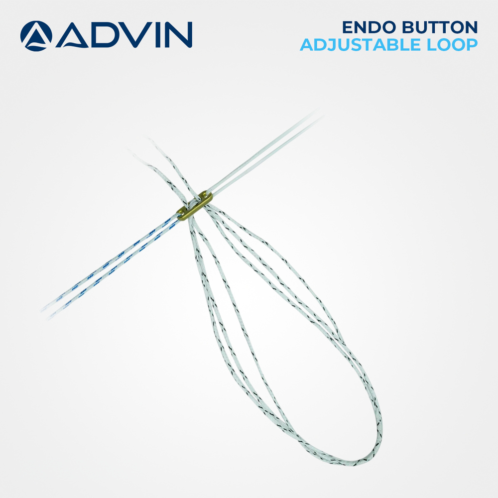Endo Button Adjustable Loop - Orthopedic Implant for ACL Reconstruction | Enhanced Fixation Strength, Stress Reduction, Minimal Invasion Technique