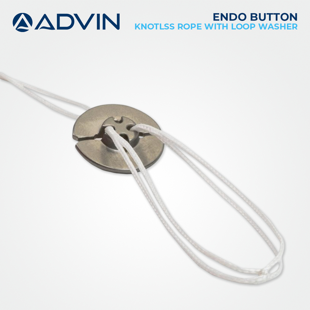 Endo Button Knotless Rope with Loop Washer - Biocompatible Material, Strong and Reliable Fixation | Knotless Design, Loop Washer for Secure Attachment