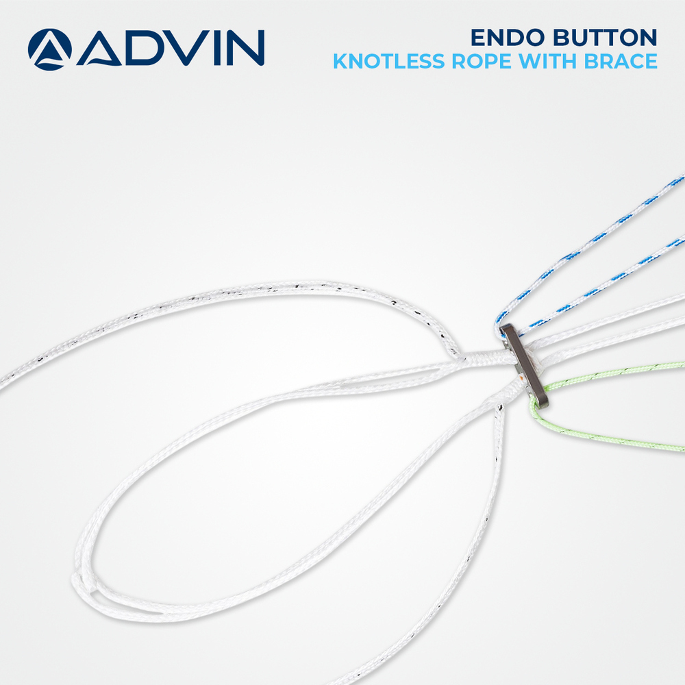 Endo Button Knotless Rope With Brace - High-strength Fiber, Versatile Design , Improved Fixation, Minimal Invasion For Acl Repair